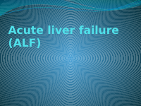 Acute liver failure.pptx